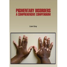 Pigmentary Disorders A Comprehensive Compendium