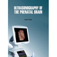 Ultrasonography of the Prenatal Brain