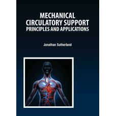 Mechanical Circulatory Support: Principles and Applications