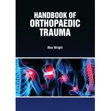 Handbook of Orthopaedic Trauma