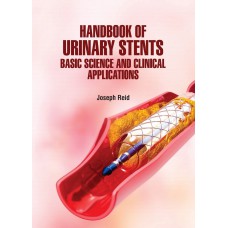 Handbook of Urinary Stents : Basic Science and Clinical Applications
