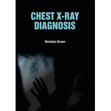 Chest X-ray Diagnosis
