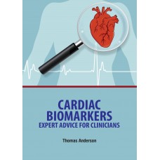 Cardiac Biomarkers: Expert Advice for Clinicians