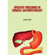 Operative Procedures in Surgical Gastroenterology